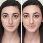 Течен коректор за възпаления и несъвършенства Zap&Hide® – Jane Iredale-z1