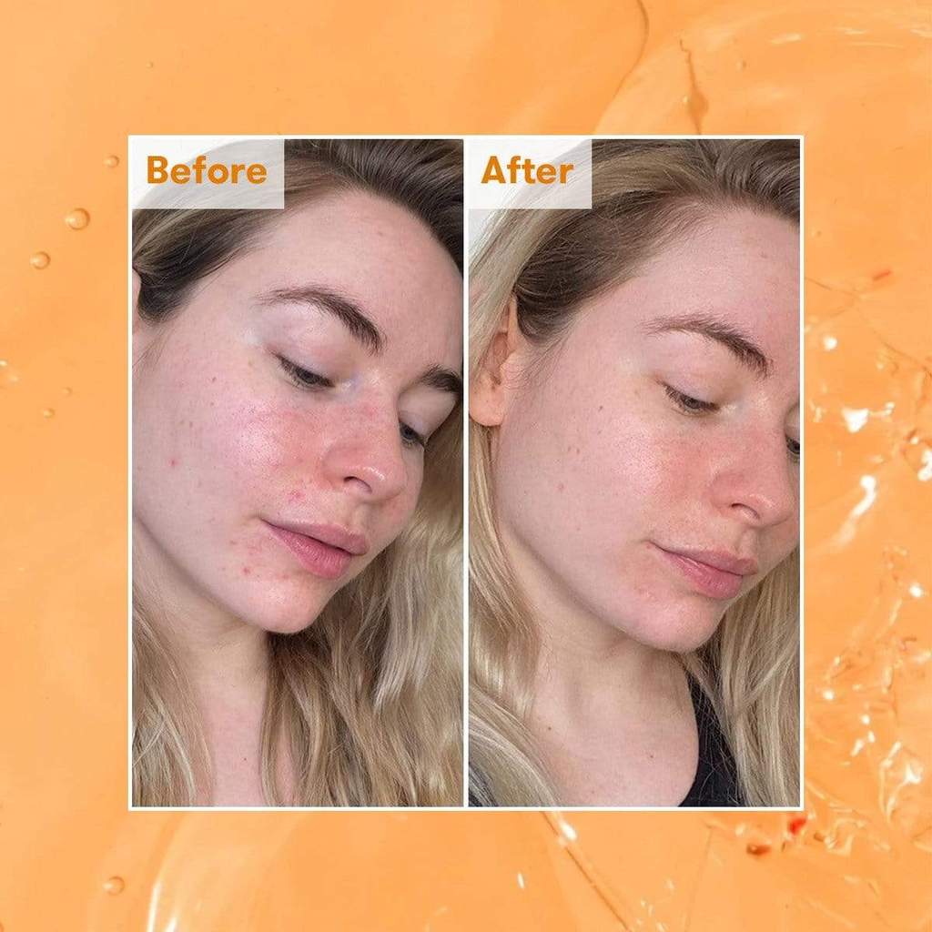 renskincare-ready-steady-glow-daily-aha-тоник-за-чиста-кожа-одоната
