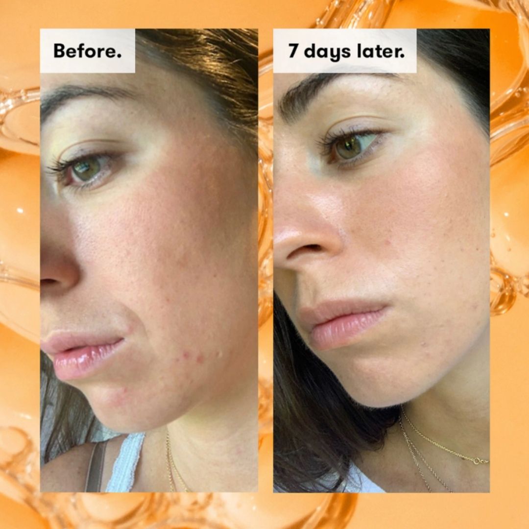 renskincare-ready-steady-glow-daily-aha-тоник-за-чиста-кожа-одоната