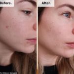 ren-skincare-крем-против-пигментации-2