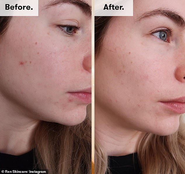 ren-skincare-крем-против-пигментации-3