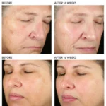 pca-skin-pigment-gel-pro