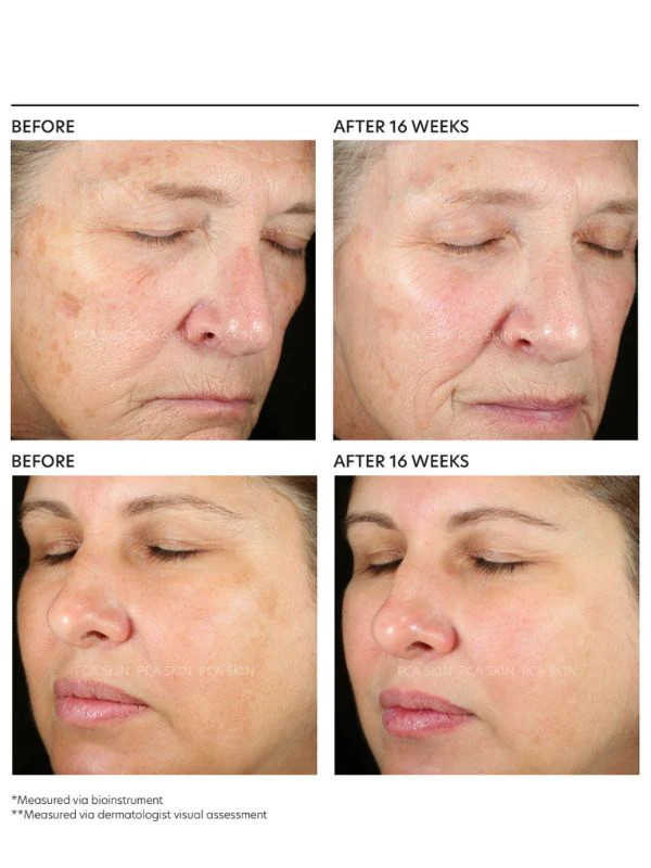 Pigment Gel® Pro - професионален серум при пигментации Pigment Gel® Pro - професионален серум при пигментации