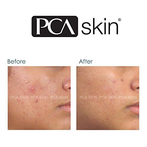 pca-skin-blemish-control-bar