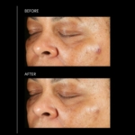 pca-skin-pigment-gel-pro